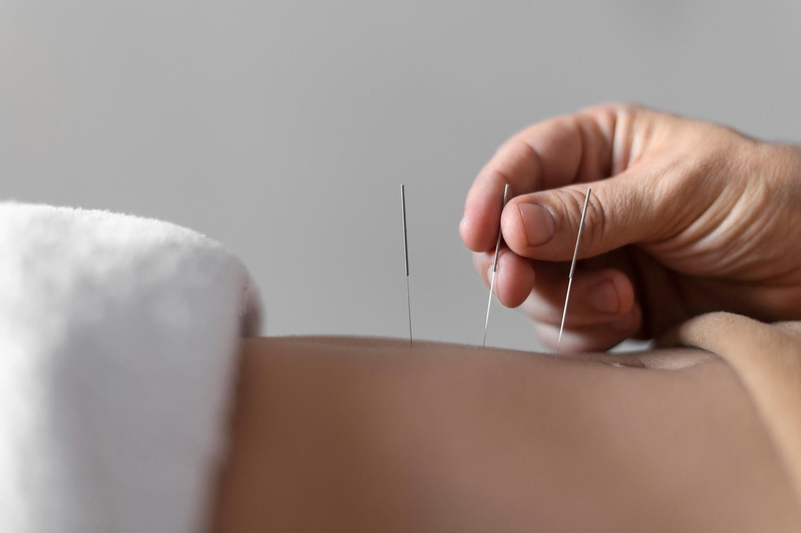 Acupuntura a laser na Recorpore